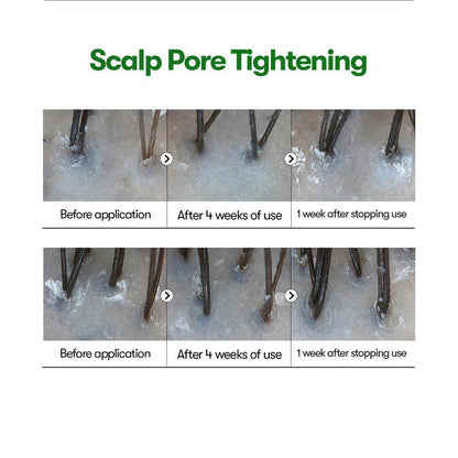 Ampolla capilar Reedle Shot – Ampolla hidratante para el cuero cabelludo (100 ml)