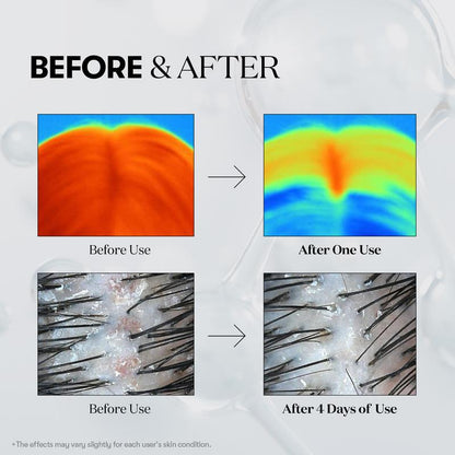 Ampolla capilar Reedle Shot – Ampolla hidratante para el cuero cabelludo (100 ml)