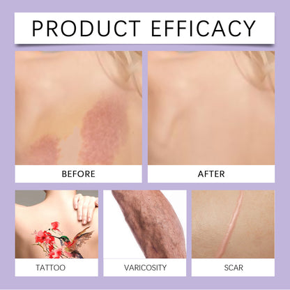 EELHOE Body Coverage Perfecting Concealer Cream – Long-Lasting Natural Finish